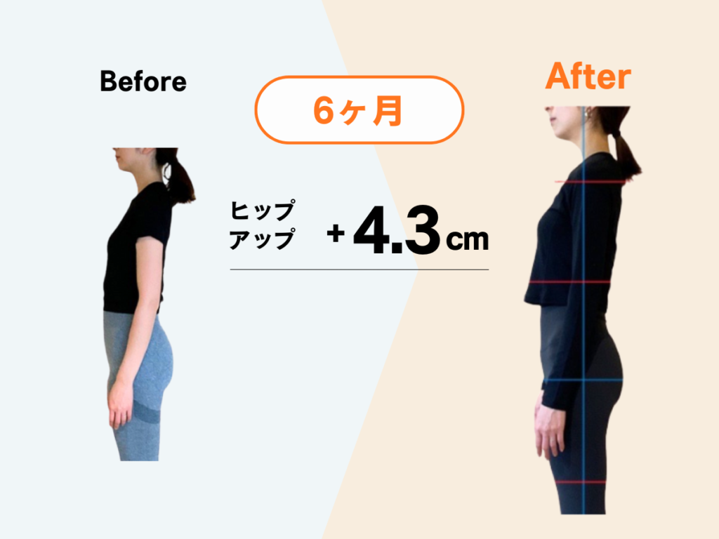 Maikaiパーソナルジムのお客様のビフォーアフター：姿勢改善&ヒップアップ+4.3cm