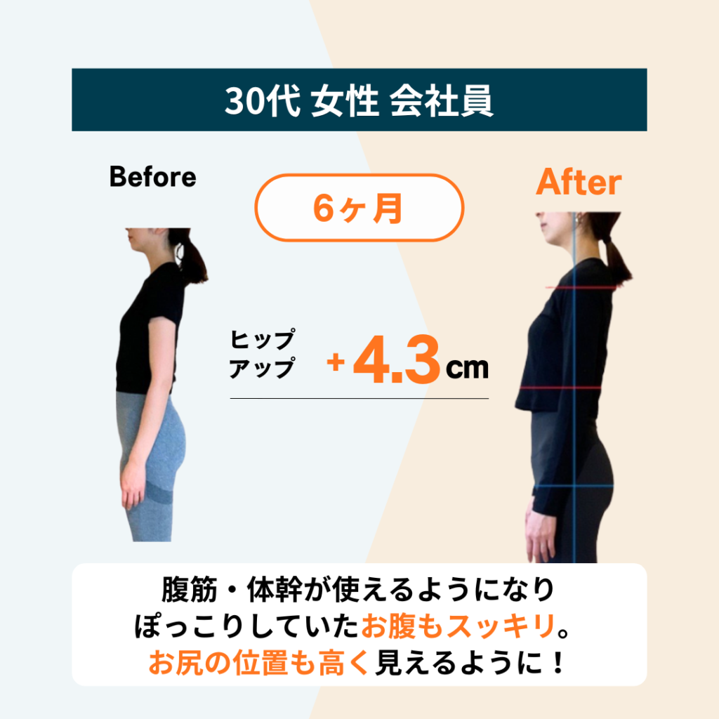 Maikaiパーソナルジムのお客様のビフォーアフター：姿勢改善&ヒップアップ+4.3cm